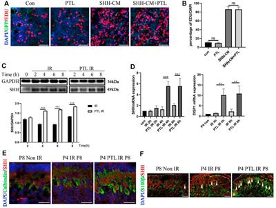 Parthenolide promotes expansion of Nestin+ progenitor cells via Shh modulation and contributes to post-injury cerebellar replenishment